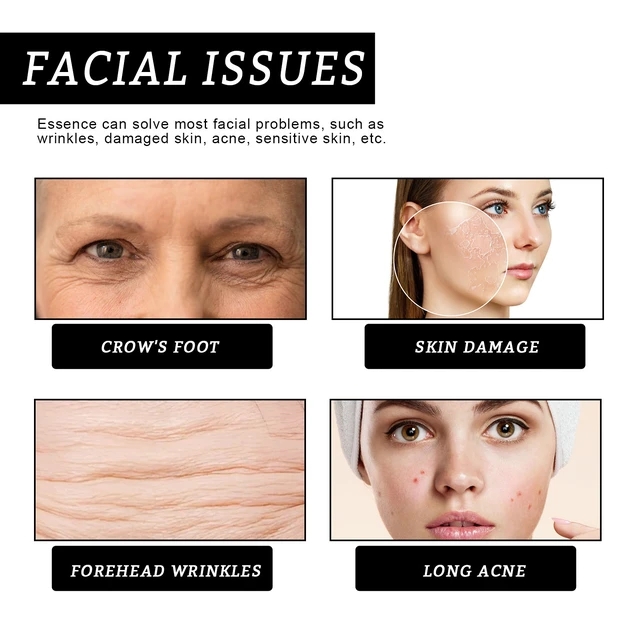 Alt view image 3 of 7 - Anti-Wrinkle Essence Water Rehydration Repair Skin Barrier Elastic Moisturizing Compact Whitening Facial Fading Color Spots Fine lines