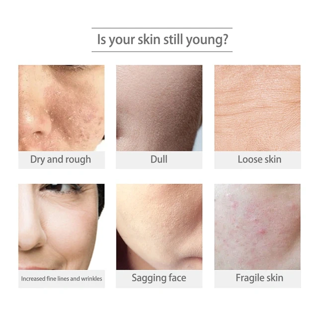 Alt view image 4 of 6 - Reduces Fine Lines for Tighter Skin, Moisturizing & Pore Minimizing, Anti-Wrinkle Firming Mask