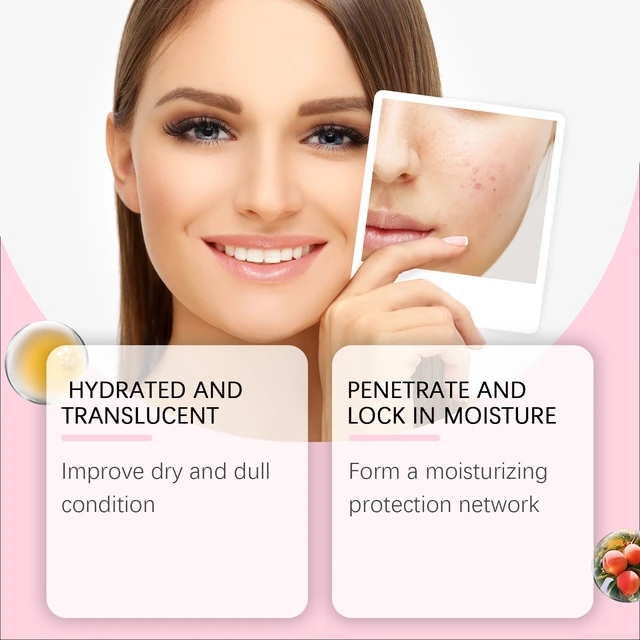 Alt view image 3 of 5 - Gentle Moisturizer to Brighten Complexion and Reduce Dullness, HANCHOBIT Niacinamide Hydrating Essence for Radiant Skin