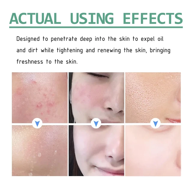 Alt view image 4 of 6 - Green Tea Purifying Mud Face Mask Deep Cleansing Hydrating Brightening Acne Removal Skincare