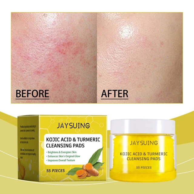 Main image of and Radiance Enhancement, Hydration Boost, Skin Repair, Turmeric Cleansing Pads for Gentle Exfoliation