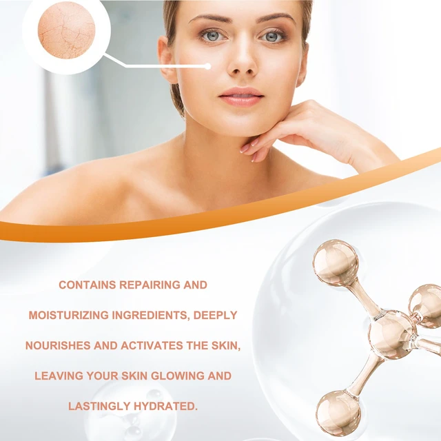 Alt view image 3 of 5 - Non-Greasy Hydrating Formula, Radiant Concealer Cream - Acne Fade & Skin Tone Brightening