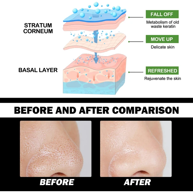 Alt view image 4 of 5 - Moisturizing Acne Care Mud Mask for Pore Shrinking & Oil Control, Bamboo Charcoal Peel-off Blackhead Mask