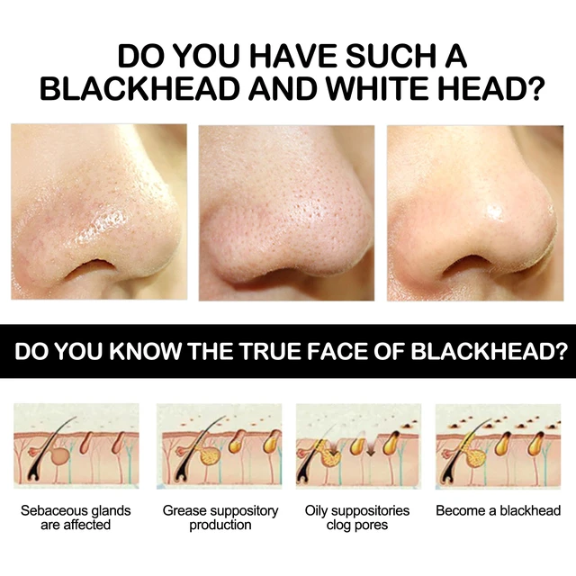 Alt view image 3 of 5 - Moisturizing Acne Care Mud Mask for Pore Shrinking & Oil Control, Bamboo Charcoal Peel-off Blackhead Mask