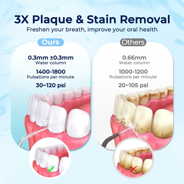 Alt view image 5 of 7 - Portable Water Flosser for Teeth Mini Travel Water Flosser | 5 Custom Modes|5 Nozzles|180ML Tank|Smart Timer|IPX7 Waterproof Cordless Oral Irrigator for Brace & Sensitive Teeth Care