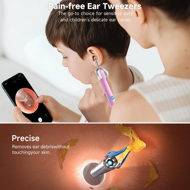 Alt view image 4 of 7 - R1 Ultra Ear Wax Removal Tweezers: 1296P HD Ear Camera Cleaner IP67 | FSA/HSA Painless Tweezers & Visual Dropper Tool, Help Remove Various Earwax with 11 Tips, 3-Piece Slicone ENT Home Check Kits