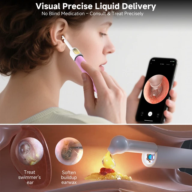 Alt view image 5 of 7 - R1 Ultra Ear Wax Removal Tweezers: 1296P HD Ear Camera Cleaner IP67 | FSA/HSA Painless Tweezers & Visual Dropper Tool, Help Remove Various Earwax with 11 Tips, 3-Piece Slicone ENT Home Check Kits