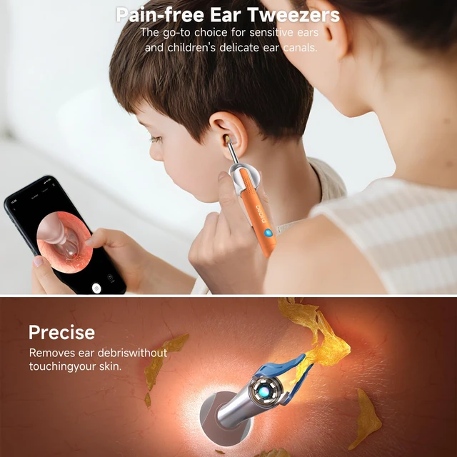 Alt view image 4 of 7 - R1 Ultra Ear Wax Removal Tweezers: 1296P HD Ear Camera Cleaner IP67 | FSA/HSA Painless Tweezers & Visual Dropper Tool, Help Remove Various Earwax with 11 Tips, 3-Piece Slicone ENT Home Check Kits