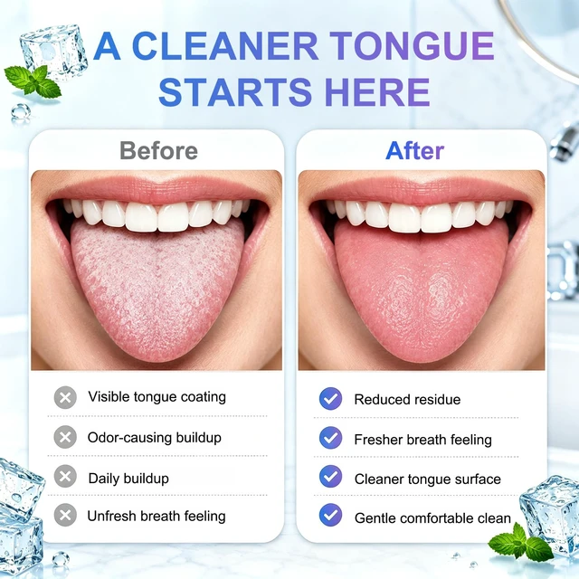 Alt view image 6 of 7 - Tongue Cleaner Gel with Tongue Brush,Tongue Cleaner for Bad Breath Removal,Oral Care Kit for Men & Wowen, Tongue Cleaning Kit for Fresh Breath, Remove Tongue Coating, Fresh Mint Flavor-2 Pack