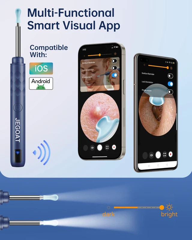 Alt view image 7 of 7 - Ear Wax Removal Kit, 1296P HD Ear Cleaner Camera Otoscope with 6 LED | 10 silicone ear tips, 6 ear spoons, IP67 waterproof, WiFi for iOS & Android, USB-C rechargeable, FSA HSA eligible, for family