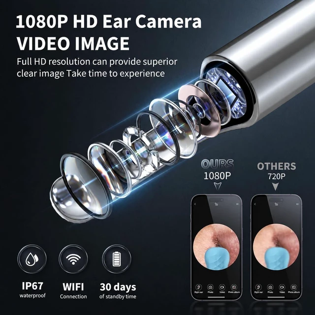 Alt view image 2 of 7 - Ear Wax Removal Kit with Camera, Otoscope with 7 Ear Spoon | 1080P HD ear cleaner, 6 LED lights, 7 ear spoons, 6 ear tips, works with iOS and Android