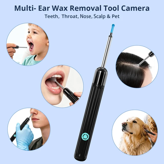 Alt view image 6 of 7 - Ear Wax Removal Kit,Ear Cleaner with Camera, 1080P HD Ear Camera with Light, Safe & Gentle Ear Camera Wax Removal Tool,IP67 Waterproof Ear Cleaning Camera,Compatible with iOS & Android