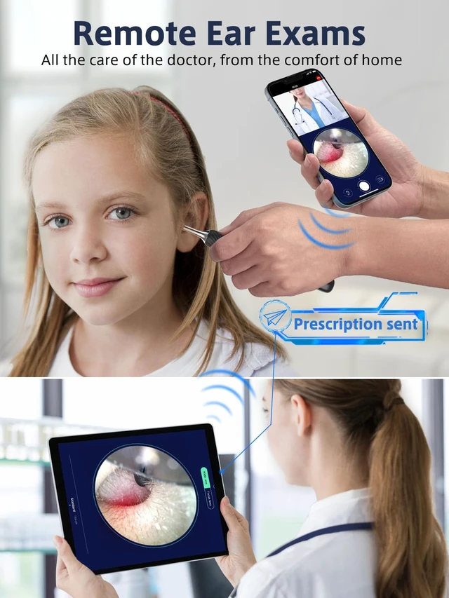 Alt view image 2 of 7 - Ear Wax Removal Tool with Real-time Remote Video, 3-in-1 Ear Cleaner Earwax Removal Kit with Ear Pick & Tweezers Mode, 10MP Ear Camera Otoscope with Light, 12 Pcs Ear Scoops for Whole Family