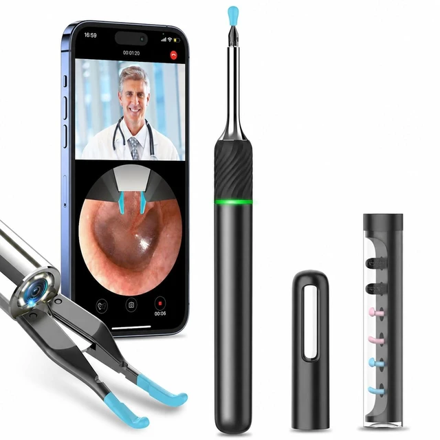 Main image of Ear Wax Removal Tool with Real-time Remote Video, 3-in-1 Ear Cleaner Earwax Removal Kit with Ear Pick & Tweezers Mode, 10MP Ear Camera Otoscope with Light, 12 Pcs Ear Scoops for Whole Family