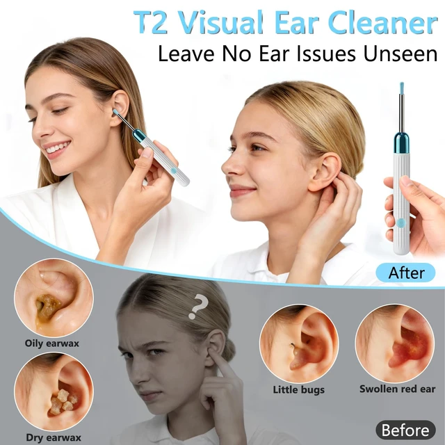 Alt view image 2 of 6 - Ear Wax Removal Tool Camera, 1080P HD Ear Cleaner with 6 LED Lights & 6 Ear Picks, Earwax Remover Kit with Camera, Compatible with iOS & Android for Adults & Kids