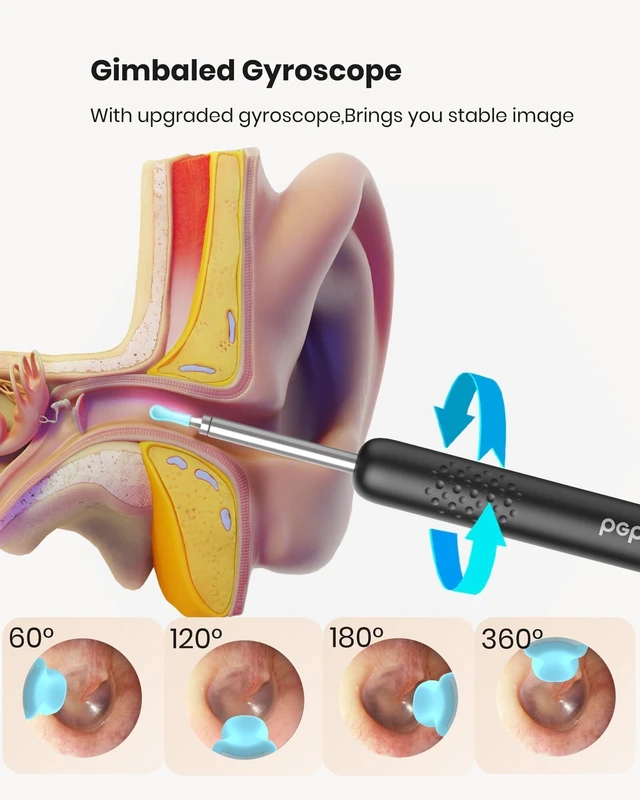 Alt view image 13 of 14 - R1 Ear Wax Removal:Ear Cleaner with HD Ear Camera FSA, Black | Solve earwax buildup Removal - 10 replacement tips for various needs - HD visual with led & silicone 3-piece set ensures safe