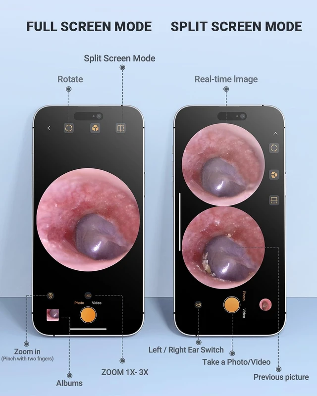 Alt view image 10 of 14 - Digital Otoscope Compatible with iPhone & Android, Video Ear Scope Camera | Otoscope with Light, 3.9mm Lens, Plug & Play, Photo & Video, Split-screen, Earwax Removal Kit for Home Cleaning Checking