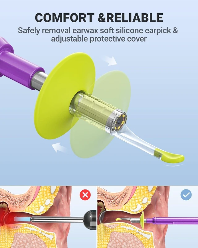 Alt view image 11 of 14 - Digital Otoscope Compatible with iPhone & Android, Video Ear Scope Camera | Otoscope with Light, 3.9mm Lens, Plug & Play, Photo & Video, Split-screen, Earwax Removal Kit for Home Cleaning Checking