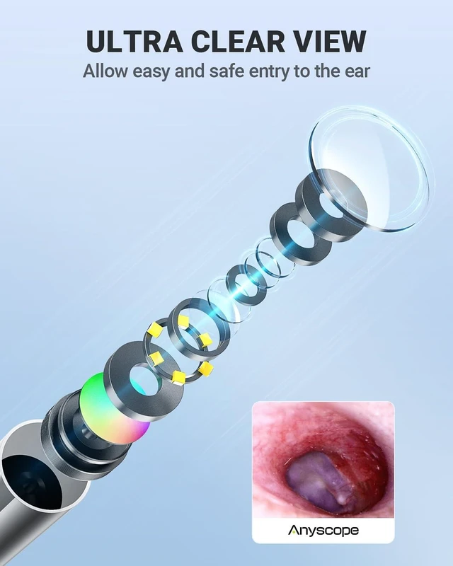 Alt view image 14 of 14 - Digital Otoscope Compatible with iPhone & Android, Video Ear Scope Camera | Otoscope with Light, 3.9mm Lens, Plug & Play, Photo & Video, Split-screen, Earwax Removal Kit for Home Cleaning Checking