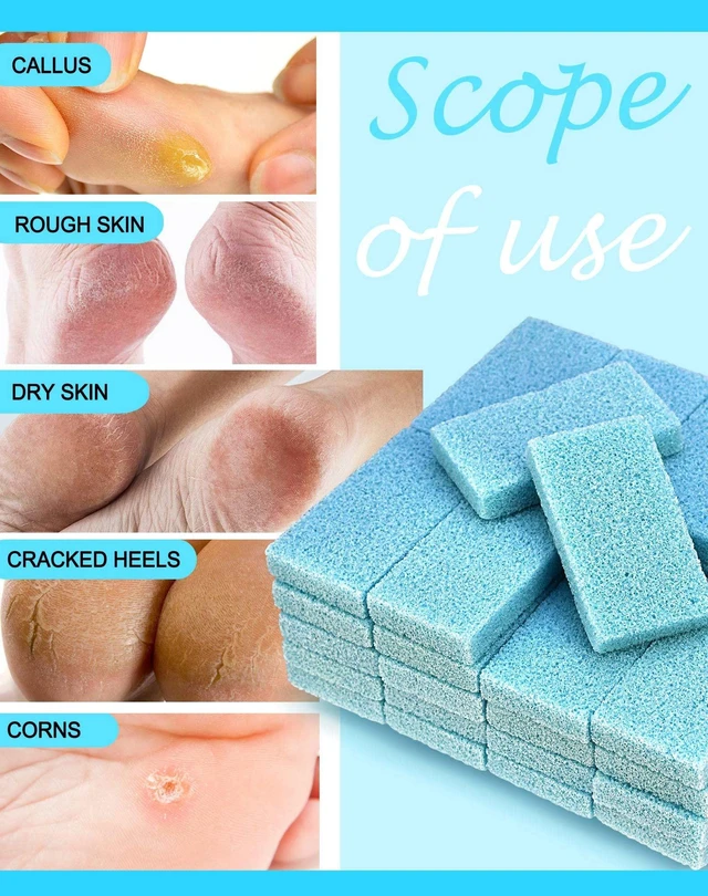 Alt view image 2 of 7 - Disposable Foot Scrubber Pedicure Pumice Stone for Feet, 40PCS | Medium Coarse Scrubbing Pads, Salon Grade, Dead Skin Callus Remover, Blue