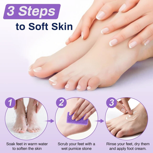 Alt view image 6 of 7 - 20 Small Pumice Stone for Feet - 3.6"x 1.8"x 0.5" Foot Pumice Stone | Purple Foot Filer, Pedicura Scrubber, Foot Care Spa Productos for Callus Removal, Dark Elbows, Hard Skin Exfoliating