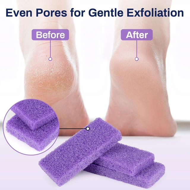 Alt view image 5 of 7 - 20 Small Pumice Stone for Feet - 3.6"x 1.8"x 0.5" Foot Pumice Stone | Purple Foot Filer, Pedicura Scrubber, Foot Care Spa Productos for Callus Removal, Dark Elbows, Hard Skin Exfoliating