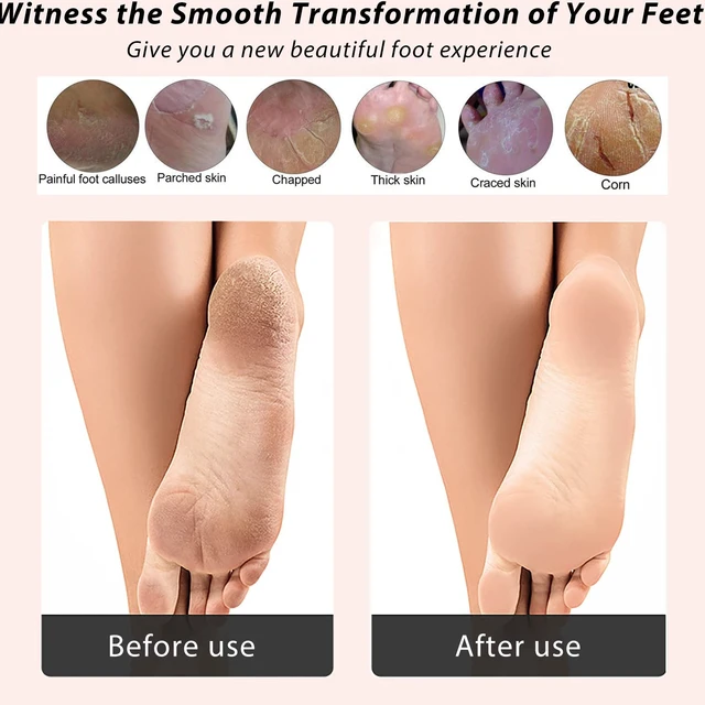 Alt view image 5 of 7 - 4 in 1 Bamboo Foot File Callus Remover Pedicure Scrubber Brush | Natural Bamboo, Stainless Steel, Pumice Stone, Boar Bristles, Exfoliating, Callus Removing, Smooth Heel Care