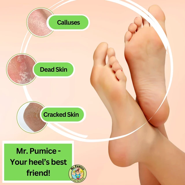 Alt view image 5 of 7 - Pumice Callus Remover Pumi Bar: Pedicure Stone & Foot Scrubber - Medium Grit (4 Pack, Colors), Assorted, (Pack of 4)