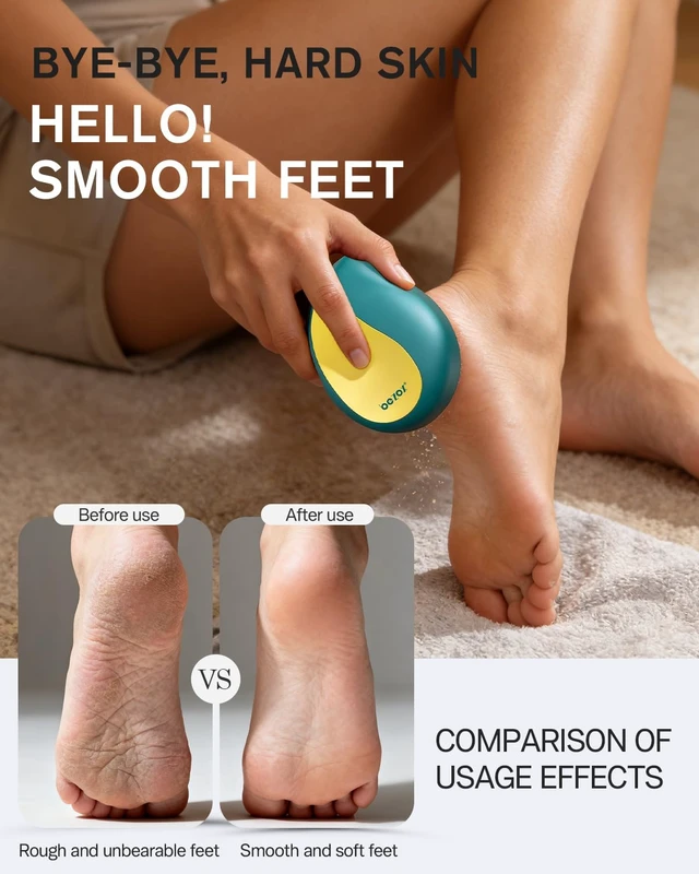 Alt view image 3 of 7 - Glass Foot Scrubber | Professional Foot File Callus Remover Premium Pumice Stone Pedicure Tools for Feet with Protective Cover - Green