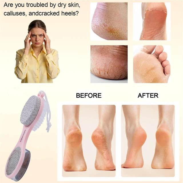 Alt view image 3 of 7 - Foot Scrubber Brush with Pumice Stone for Feet Callus Remover Pedicure Tool | 5-in-1 Foot File Dead Skin Remover, Stainless Steel Heel Scraper Shower Brush and Sand Paper Debris Catcher