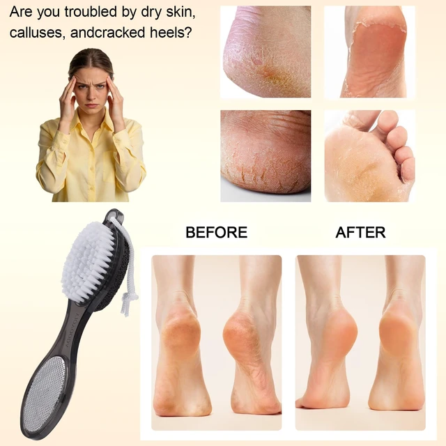 Alt view image 3 of 6 - Foot Brush and Pumice Stone for Feet Scrub Callus Remover Pedicure Tools | 4-in-1 Foot Scrubber Dead Skin Remover, Foot Rasp and Sand Paper, Multi Purpose for Home Foot Care Shower