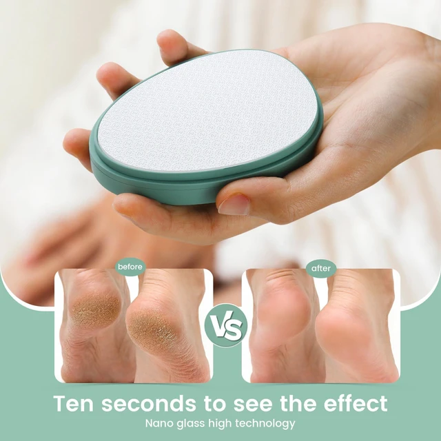 Alt view image 4 of 7 - Nano Glass Foot File Callus Remover with Cover Gentle Glass Foot Pumice Stone, Effective Feet Scrubber for Dead Skin, and Portable Pedi Egg Foot Care Tool - Green