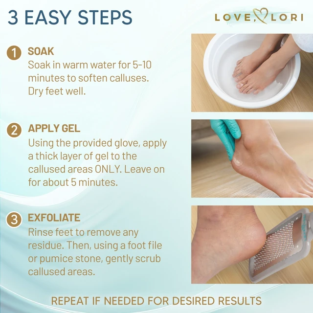 Alt view image 4 of 7 - Foot Callus Remover Kit - Gel & Foot Scraper for Dead Skin, 6oz | Complete callus remover kit for feet, extra-strength gel plus a foot scraper for salon-quality pedicure results at home