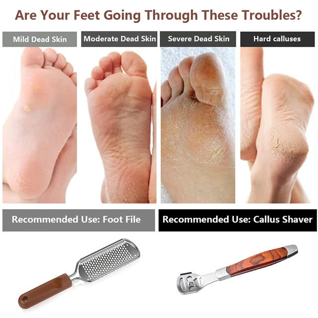Alt view image 5 of 6 - 2 Pack Pedicure Kit, Foot File Callus Remover, Heel Scraper for Feet | Stainless Steel Foot Rasp & Wood Handle Callus Shaver (10 Replacements and 1 File Foot Head), Callus Remover for Feet