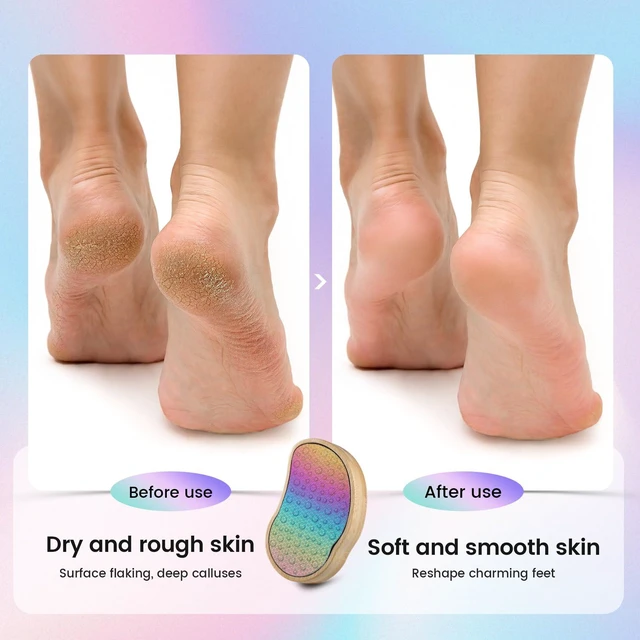 Alt view image 2 of 7 - Stainless Steel Pedi Egg Foot File Callus Remover for Dry and Wet Feet, Smooth Rough Skin, Plastic-Free Pedicure Tool Pumice Stone, Washable Foot Scrubber for Cracked Heels - Rainbow