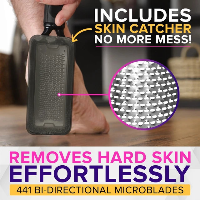Alt view image 3 of 7 - RUSTPROOF Foot File Callus Remover for Feet with Catcher | XL Size | MegaFile Hard Skin Remover Foot Scraper for Wet and Dry Use - Non-Slip Textured Grip for Smooth, Soft & Callus-Free Feet