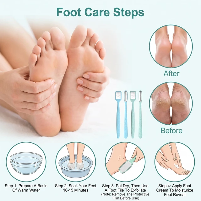 Alt view image 4 of 7 - 4 Pack Precision Callus Remover Mini Foot File Pedicure | Stainless Steel Foot Dead Skin Remover Scraper for Heel Between Toes Corn Hard Skin Exfoliator for Feet Finger Callus