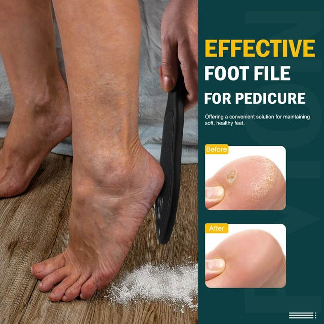 Alt view image 3 of 7 - Double-Sided Nano Glass Foot File for Callus Remover - Highly Effective Hard and Dead Skin Remover for Cracked Heels and Dry Skin (Black)