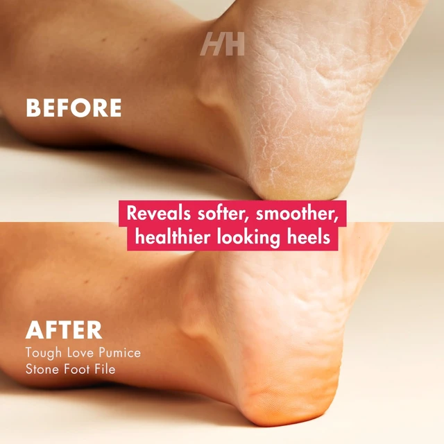 Alt view image 4 of 5 - Foot Exfoliator - Deep Skin Smoother for Dry, Rough Areas & Cracked Heels Natural Scrub for Silky Soft Skin
