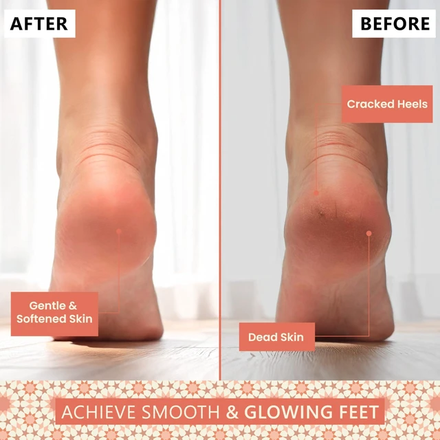 Alt view image 3 of 7 - Natural Terracotta Pumice Stone for Feet Handcrafted Foot Scrubber & Callus Remover with Gentle Exfoliation and Ergonomic Design for Smooth, Soft & Refreshed Feet for a Spa-Like Pedicure
