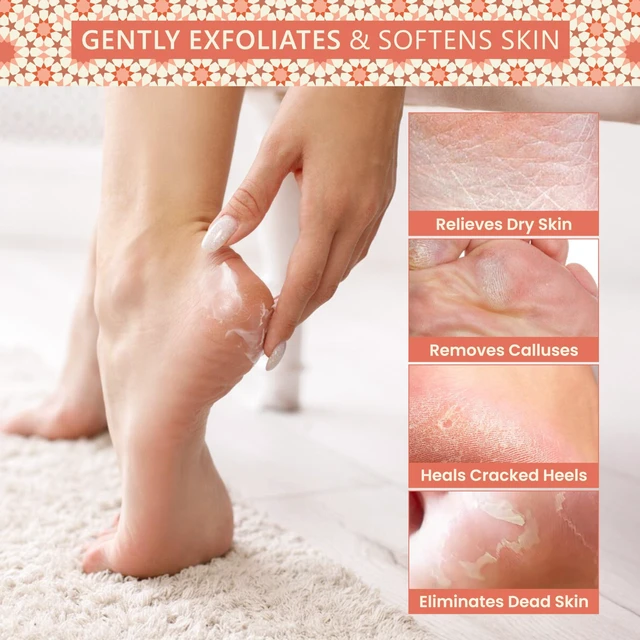 Alt view image 5 of 7 - Natural Terracotta Pumice Stone for Feet Handcrafted Foot Scrubber & Callus Remover with Gentle Exfoliation and Ergonomic Design for Smooth, Soft & Refreshed Feet for a Spa-Like Pedicure