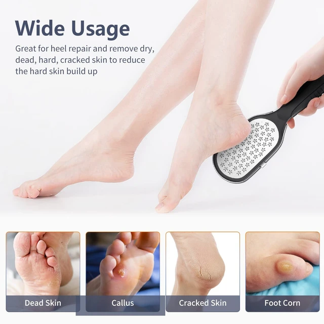 Alt view image 5 of 6 - Foot Rasp Foot File and Callus Remover. Professional Foot Care Pedicure Stainless Steel File to Remove Hard Skin.
