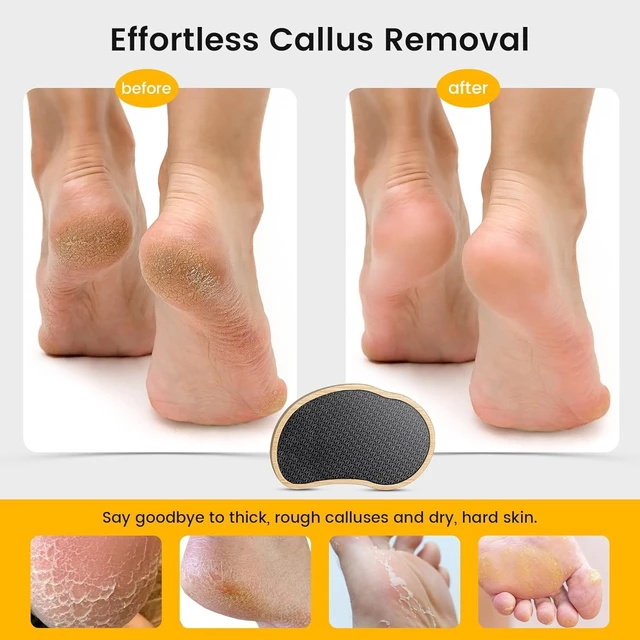 Alt view image 3 of 7 - Nano-Glass Pumice Stone for Feet Dead Skin, Eco-Friendly Pedicure Foot File Callus Remover - Bamboo Handle