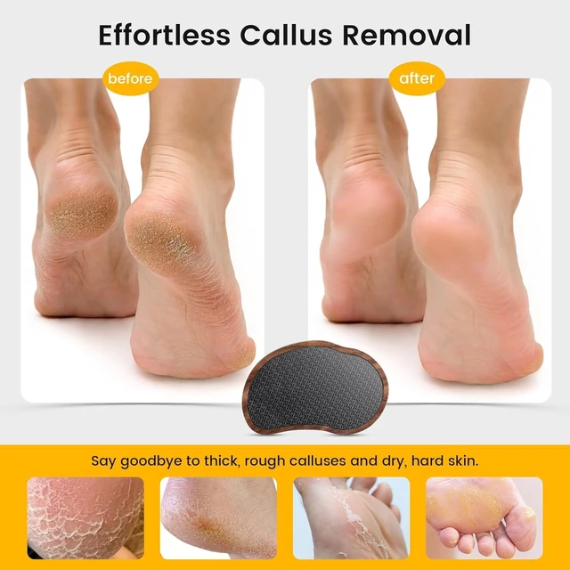 Alt view image 3 of 7 - Glass Foot File - Nano-Glass Pumice Stone Foot Scrubber, Heel File Callus Remover for Silky Smooth Feet, Portable Pedicure Tool for Summer & Vacation - Walnut Wood Handled