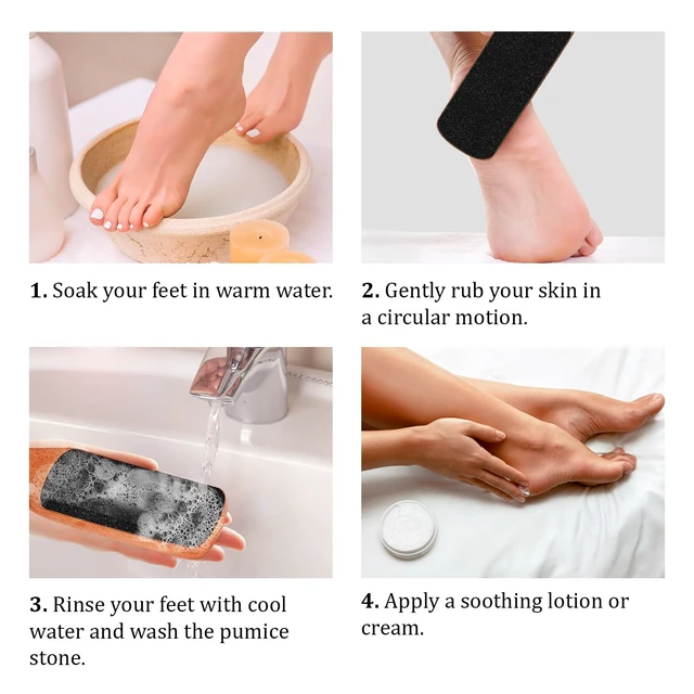 Alt view image 4 of 7 - Foot File with Handle Pumice Stone for Dry Dead Skin - Callus Remover for Feet Double-Sided Foot File for Callus, Cracked Heels, Dead, and Dry Skin Removal
