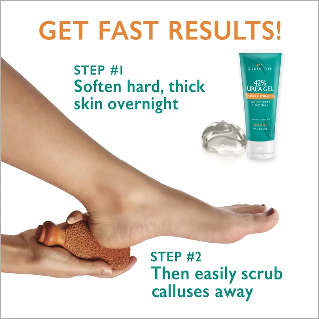 Alt view image 2 of 7 - Callus Remover Gel + Foot Scrubber Kit - Pedicure Tools for Dry Cracked Heels