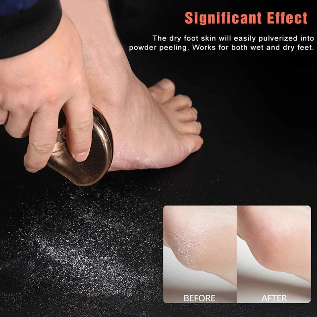 Alt view image 4 of 7 - Glass Foot File Callus Remover, Crystal Foot Scrubber Pedicure Tool | Portable Foot Scraper for Cracked Heel, Glass Pumice Stone for Wet and Dry Use - Shinning Golden