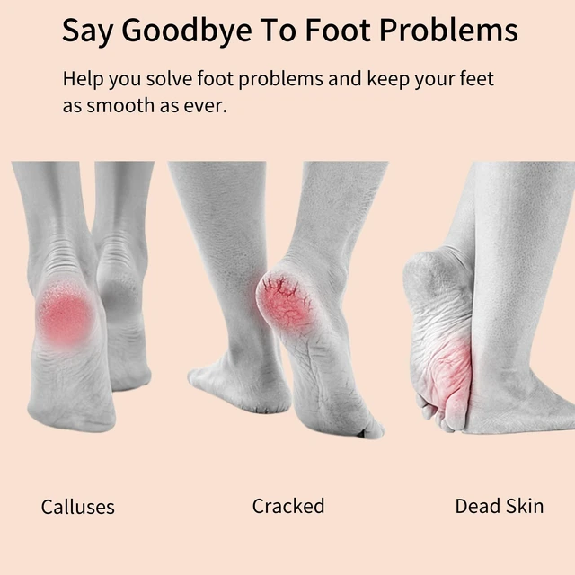 Alt view image 4 of 7 - Nano Glass Foot File, Pedicure Tool and exfoliator, Glass Surface, Comfortable Hand and Foot Grinding Scraper for Wet and Dry feet, Removal Hard or Dead Skin, Suitable for Women or Men