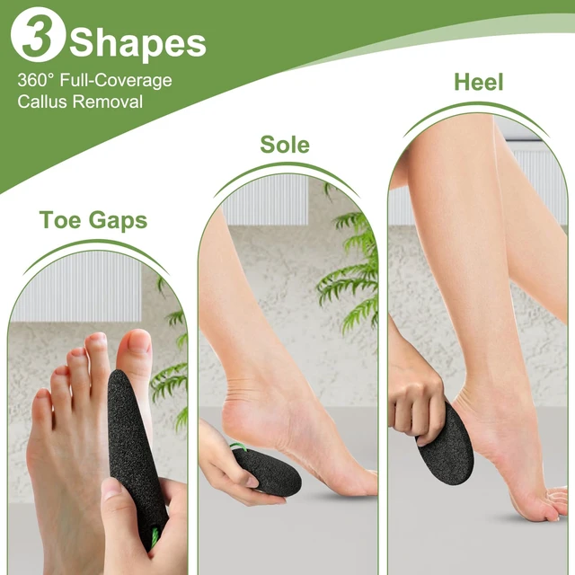 Alt view image 2 of 7 - Pumice Stone for Feet, 3 Pack Natural Earth Lava Foot Callus Remover | Pedicure Exfoliator Tools for Heels, Soles and Toe Gaps, Foot Scrubber for Dry & Dead Skin