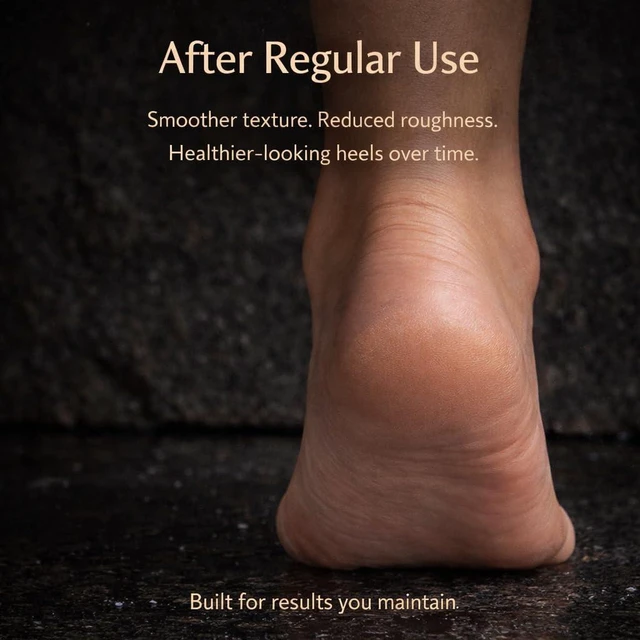 Alt view image 5 of 7 - Moroccan Pumice Stone for Feet, Terracotta Callus Remover, Cracked Heels